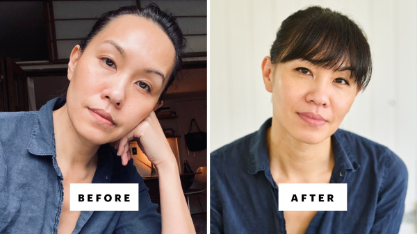 What Happened After I Quit My Botox, Fillers, Lasers, and GLP-1s